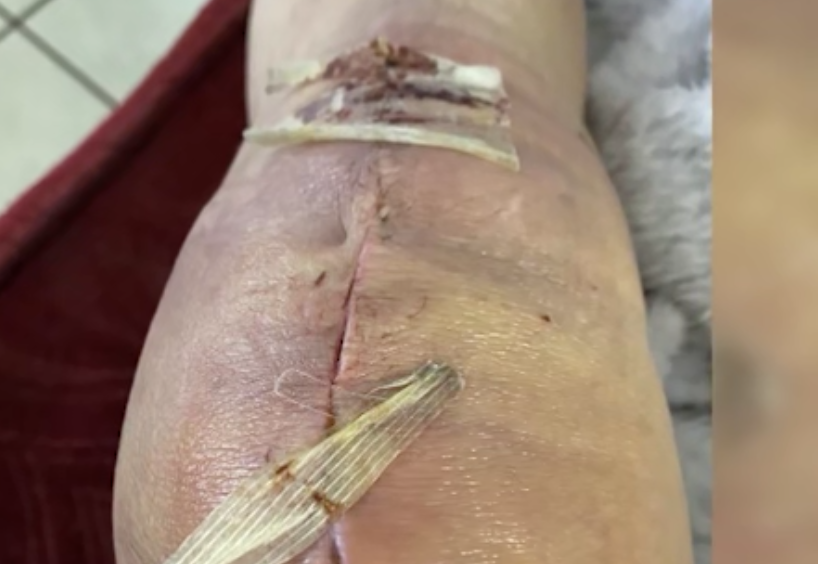 Mujer hispana denuncia presunta mala práctica médica tras múltiples cirugías en Las Vegas